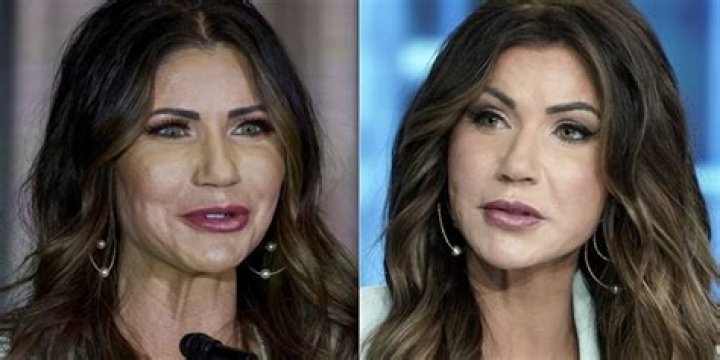 Did Kristi Noem Have Plastic Surgery? Exploring the Speculations