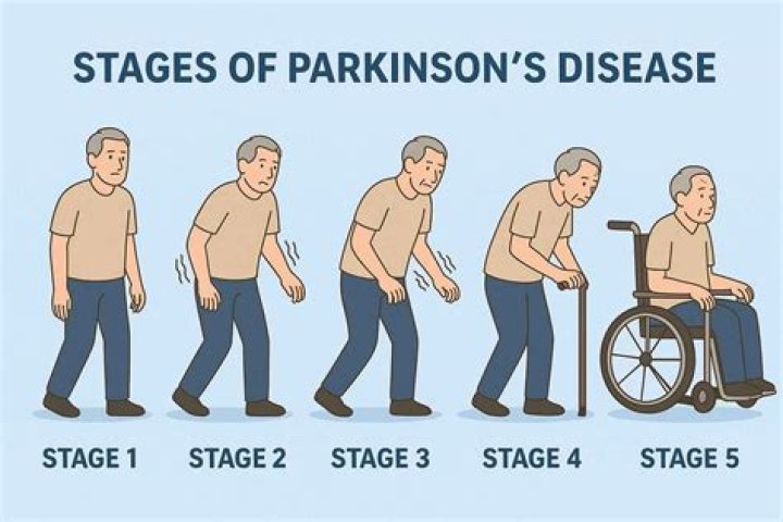 Does Mark Levin Have Parkinson's Disease?