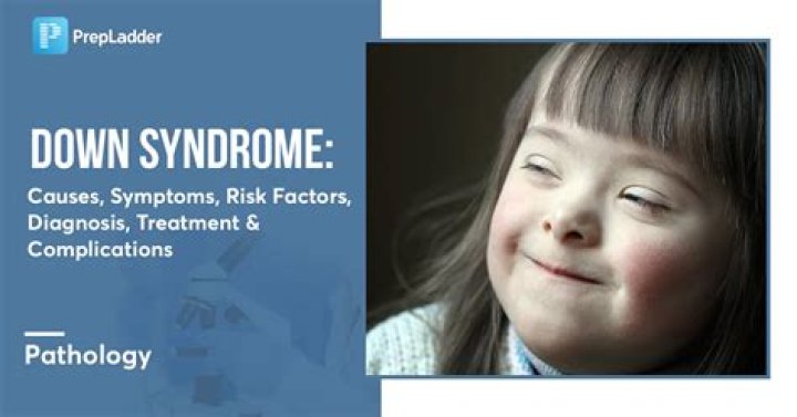 George Clooney's Twins and the Importance of Down Syndrome Awareness