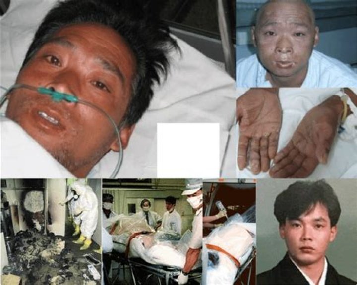 Hisashi Ouchi Pictures After Radiation: A Journey Through Tragedy and Survival