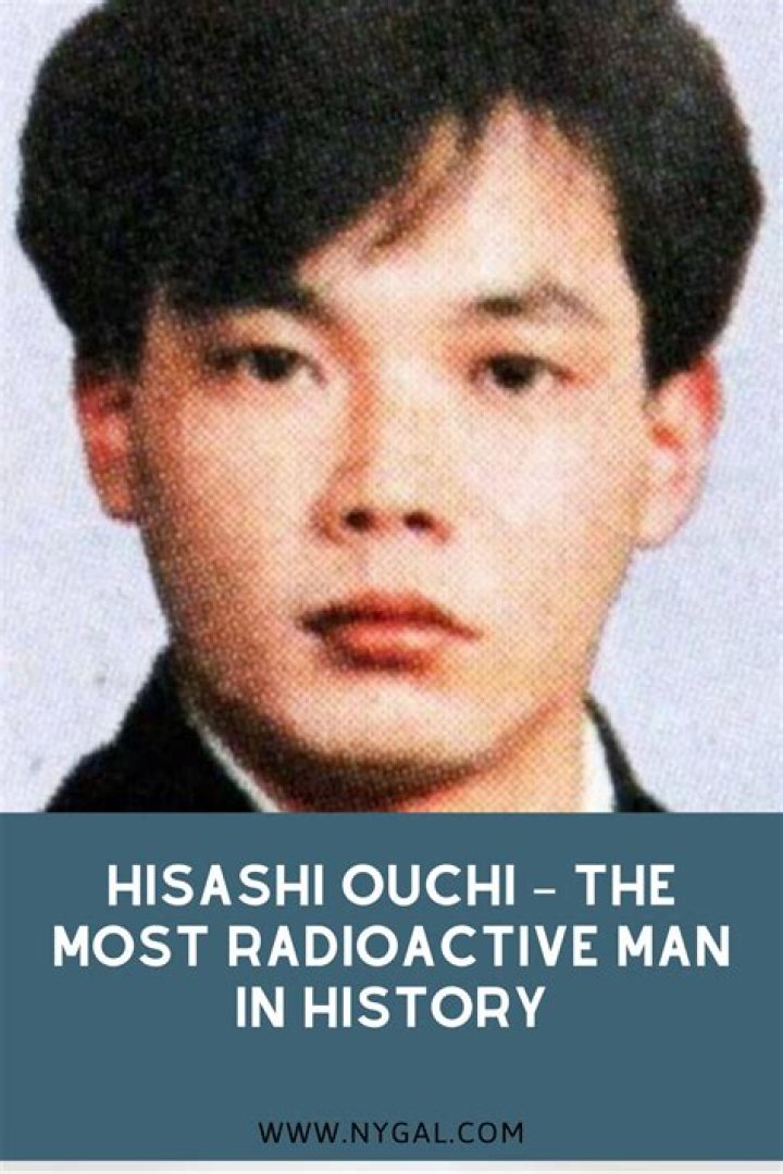 Hisashi Ouchi: The Real Body and The Tragic Story Behind It