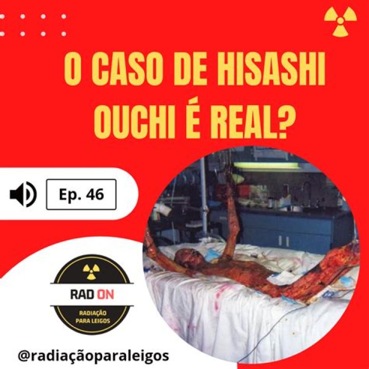 Hisashi Real: Unveiling the Truth Behind the Legend