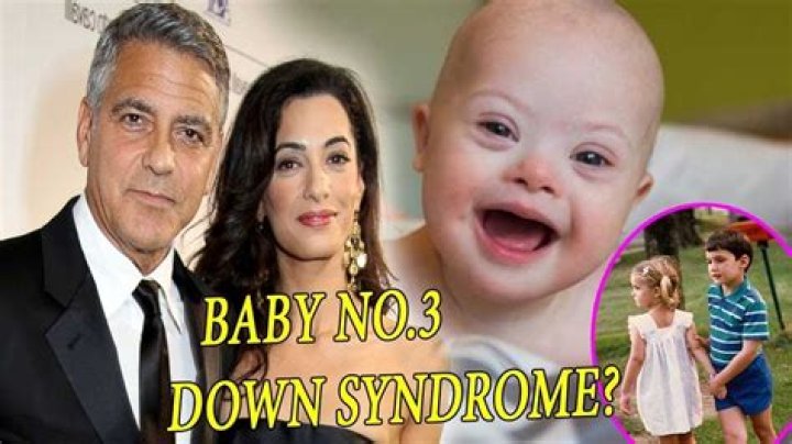 Is One of George Clooney's Twins Down Syndrome?