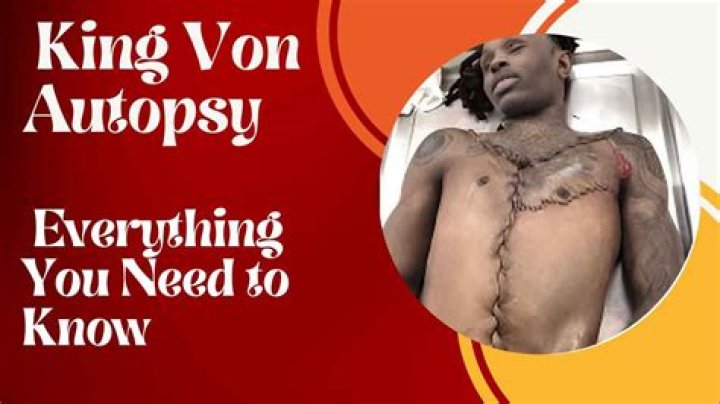 King Von Autopsy Photo: The Truth Behind the Headlines