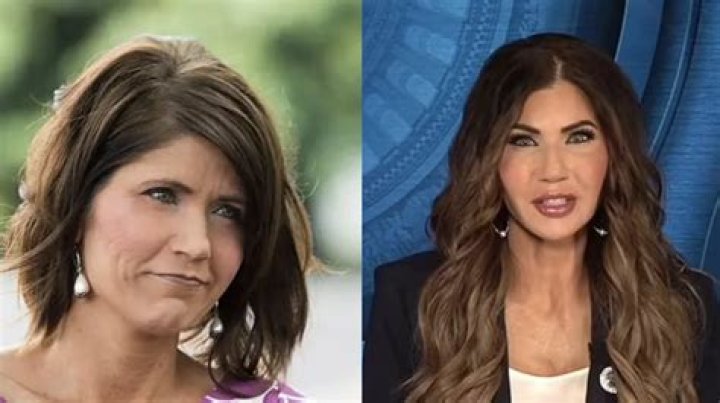 Kristi Noem Botox: Exploring the Beauty Regimen of South Dakota's Governor
