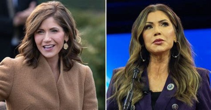 Kristi Noem Facelift: Exploring the Transformation and Public Reaction