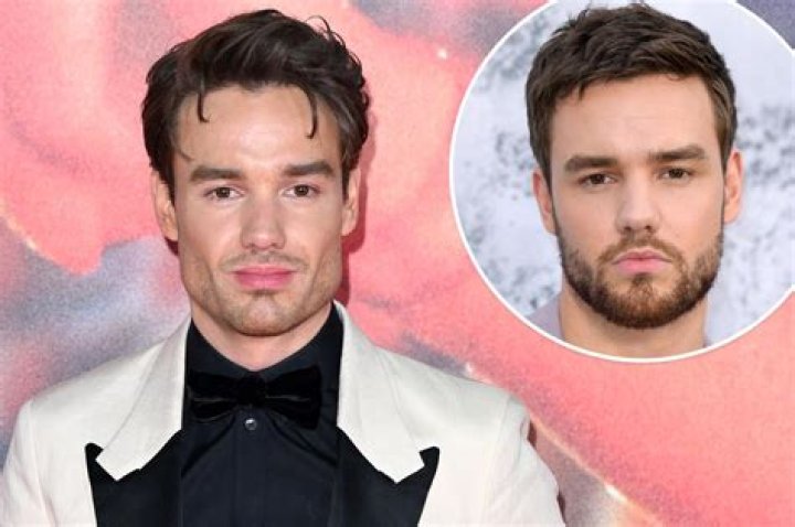 Liam Payne's Nose Job: A Deep Dive into His Transformation