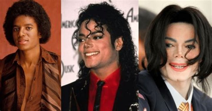 Michael Jackson Skin Bleaching: The Truth Behind the Transformation