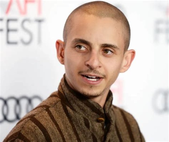Moises Arias Height Condition: Understanding the Factors Involved