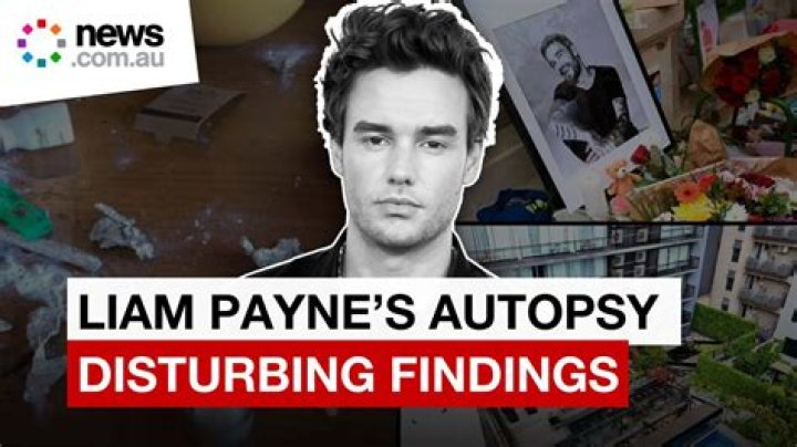 Understanding the Impact of Liam Payne and Cancel Culture